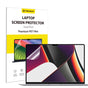 Techsuit VisionProX Anti-Blue Light, MacBook Pro 16 (2024 / 2026), Matte Clear